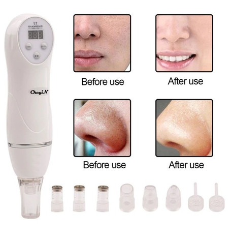 Aparelho de peeling (NOVO) Leia o anúncio - Foto 2