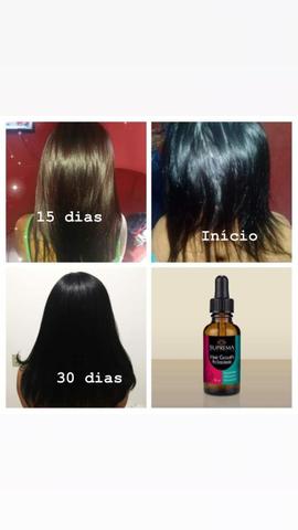 Kit monovitam + ampola minoxidil - Foto 3