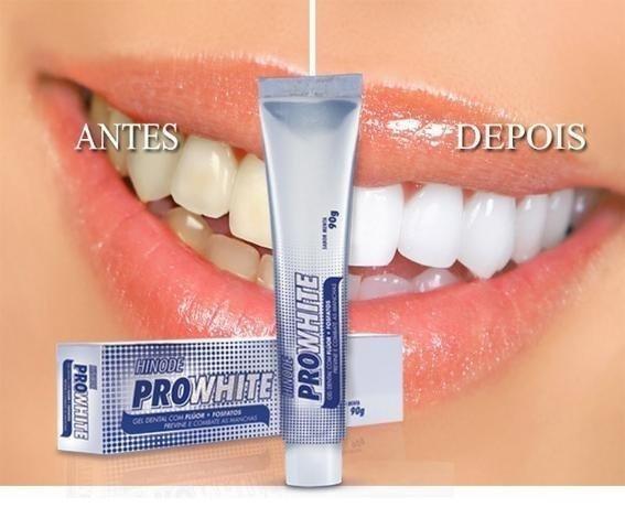 Gel Dental clareador braqueador Hinode,Itaperuna - Foto 2