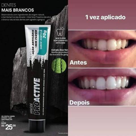 Gel Dental Carvão Hinode ativado mais Aloe vera, Itaperuna - Foto 3