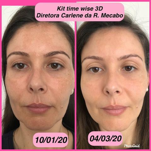 Kit maravilhoso - Foto 4