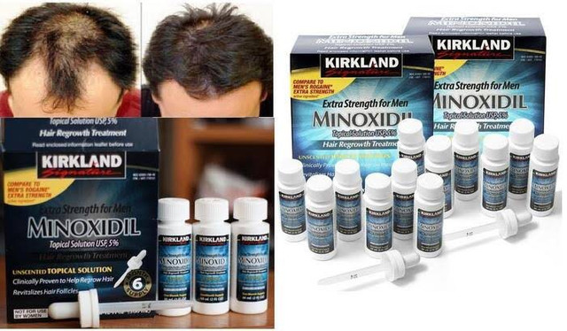 Produto para Calvície Importado - Foto 3