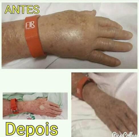 Braceletes e acessórios da Saúde ... - Foto 4
