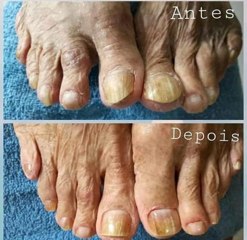 Unhas maravilhosas
