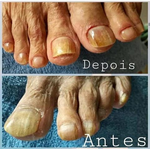Unhas maravilhosas - Foto 2