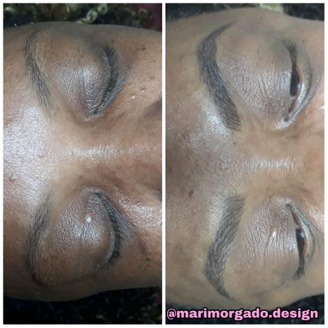 Microblading (Micropigmentação) - Foto 6