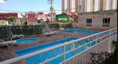 Apartamento com 2 dormitórios para alugar, 50 m² por R$ 1.350/mês - Parque Erasmo Assunção - Foto 3