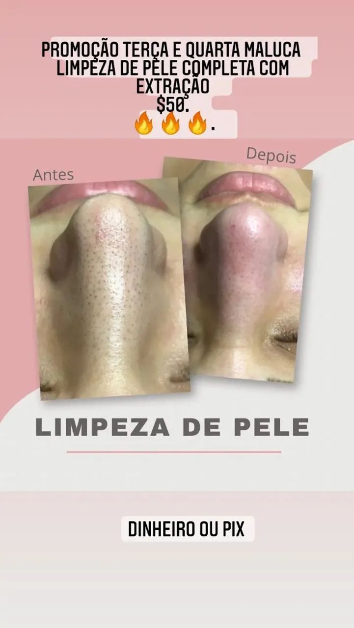 Limpeza de pele 