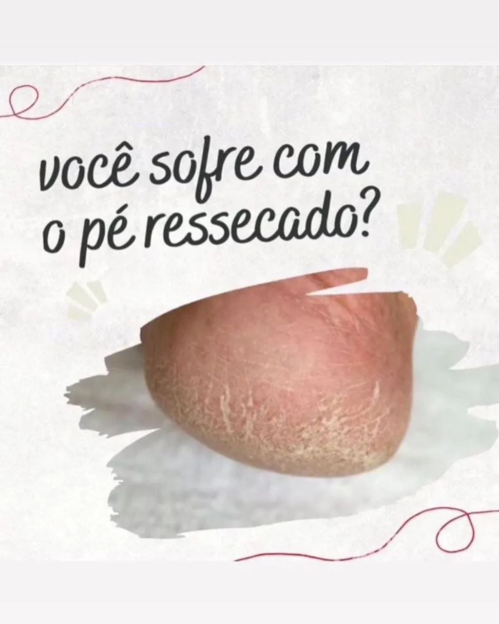 Sofre com pés e mãos ressecadas? Extraemoliente noturno da MARY