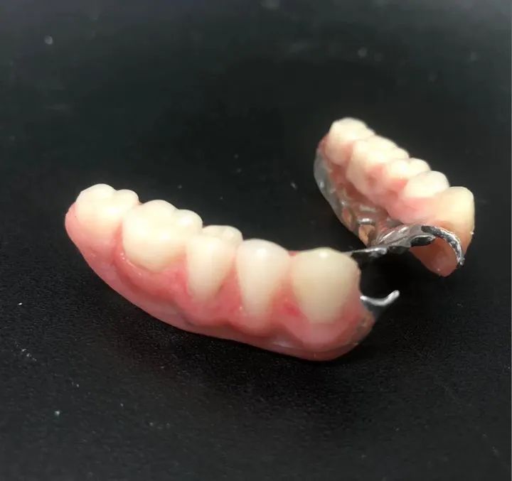 Prótese Dentária a partir de 200 reais  - Foto 2