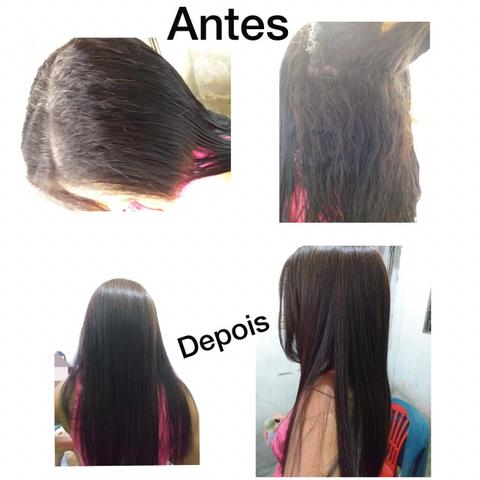 Selagem e Botox á domicílio
