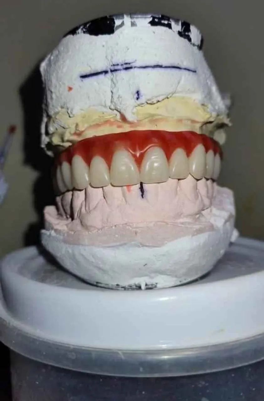 PRÓTESE DENTÁRIA Domicílio  - Foto 2