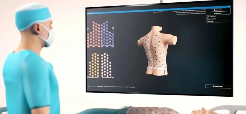 Structure Sensor 3 - Scanner Corporal 3D - Foto 5
