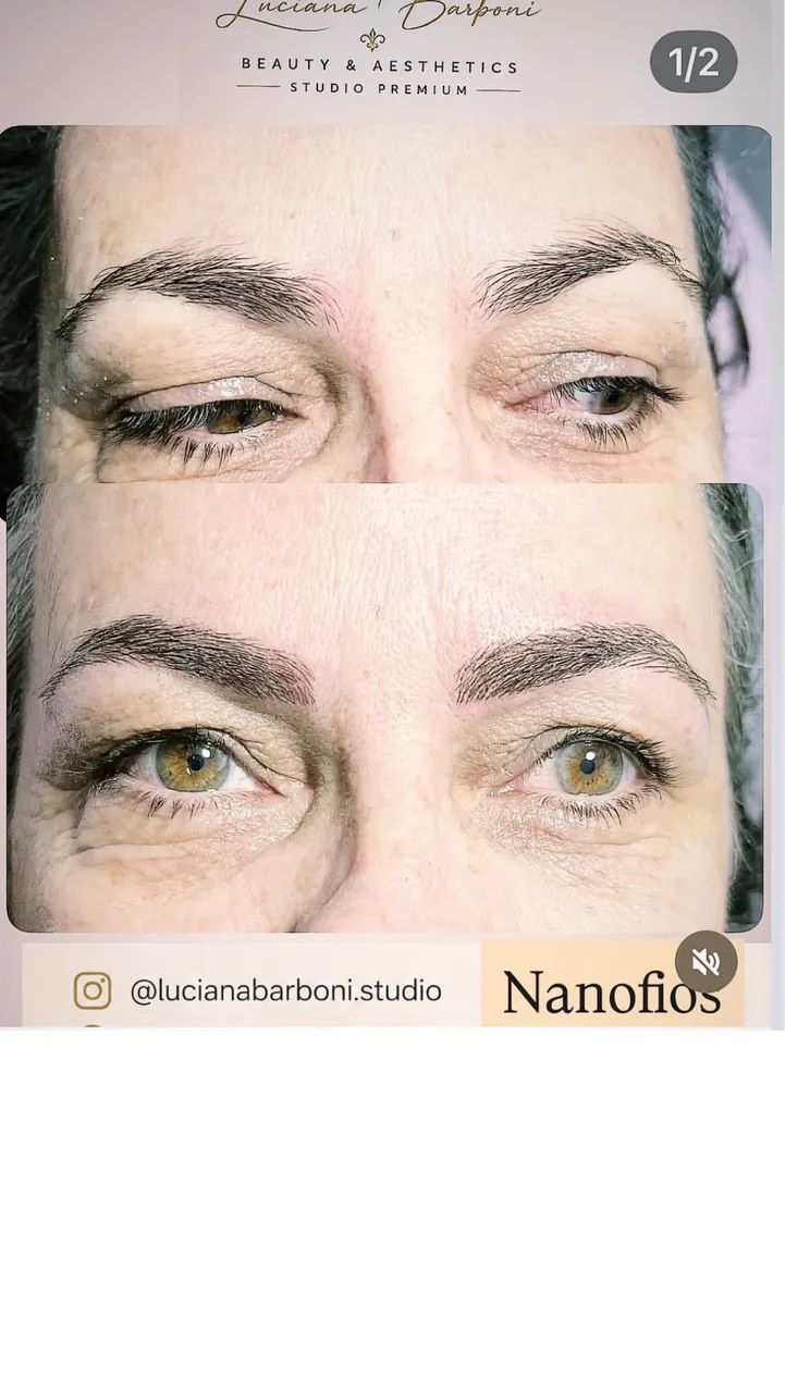 Transforme seu olhar com a Nanofios  - Foto 2