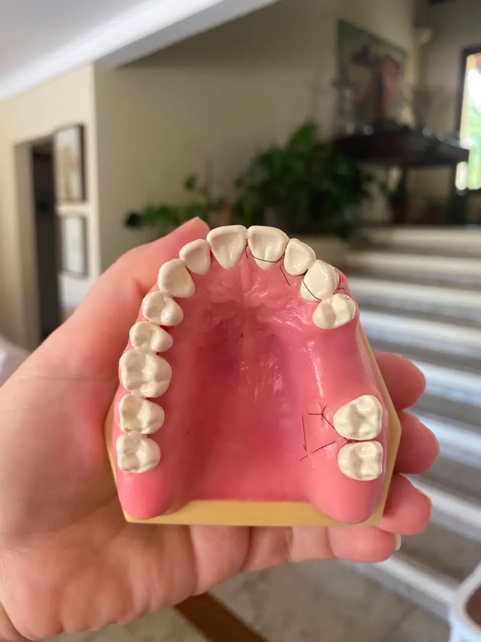Manequim de Periodontia - Foto 3