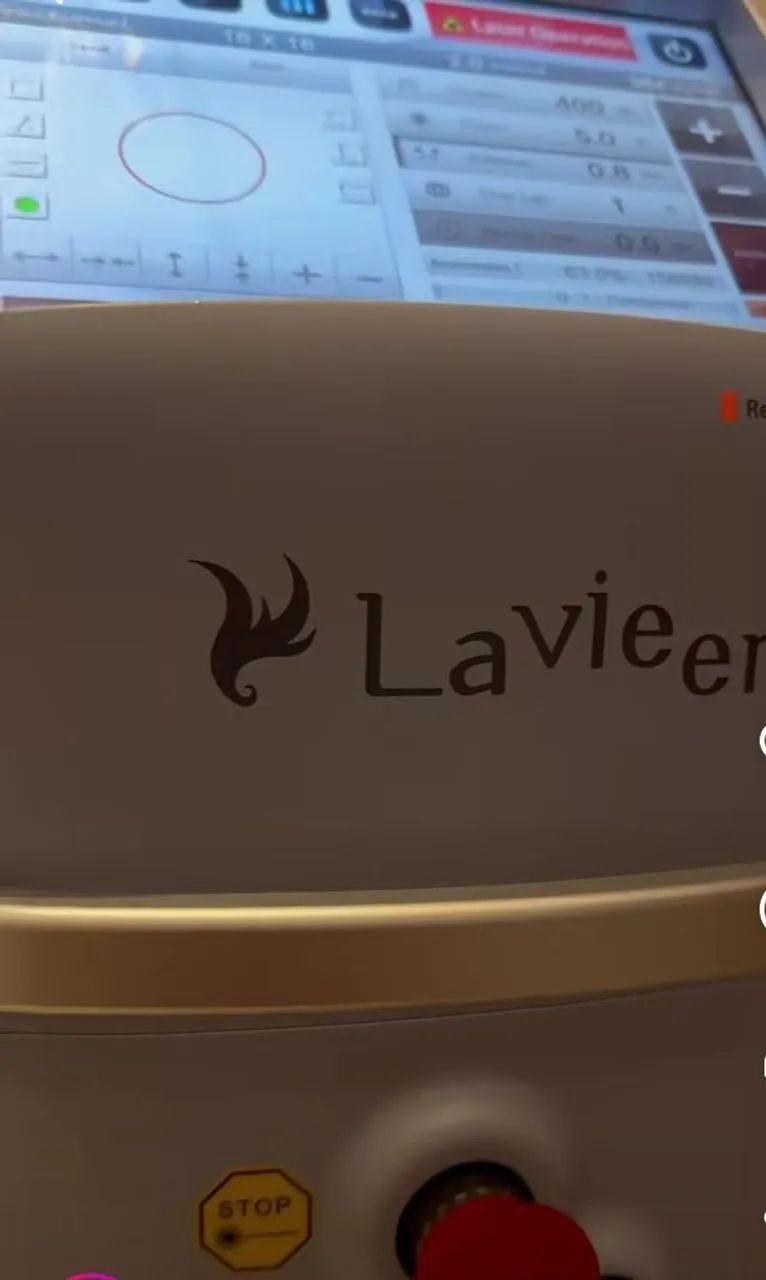 Endolaser  laser para depilação Crio - Foto 3