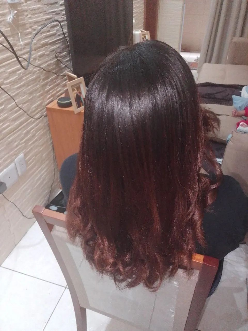 Promoção cauterização  - Foto 3
