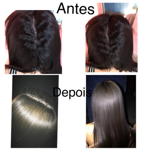 Selagem e Botox á domicílio - Foto 2