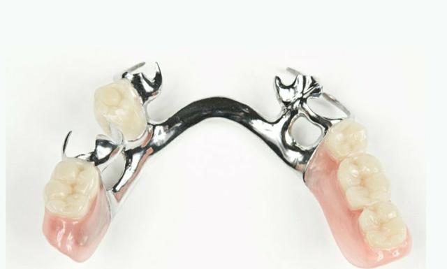 Prótese Dentária - Foto 3
