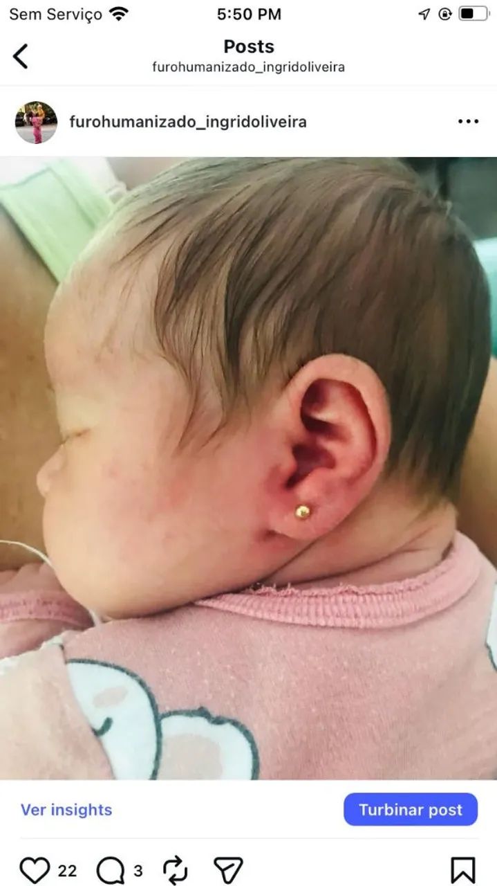 Furo humanizado - Foto 3