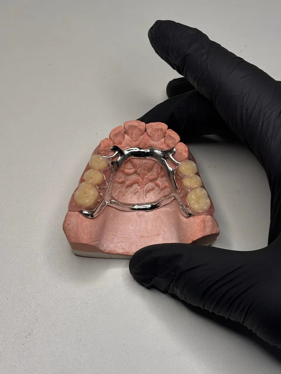 Laboratório de Prótese Dentária - Qualidade, Agilidade e Ótimo Preço! - Foto 3