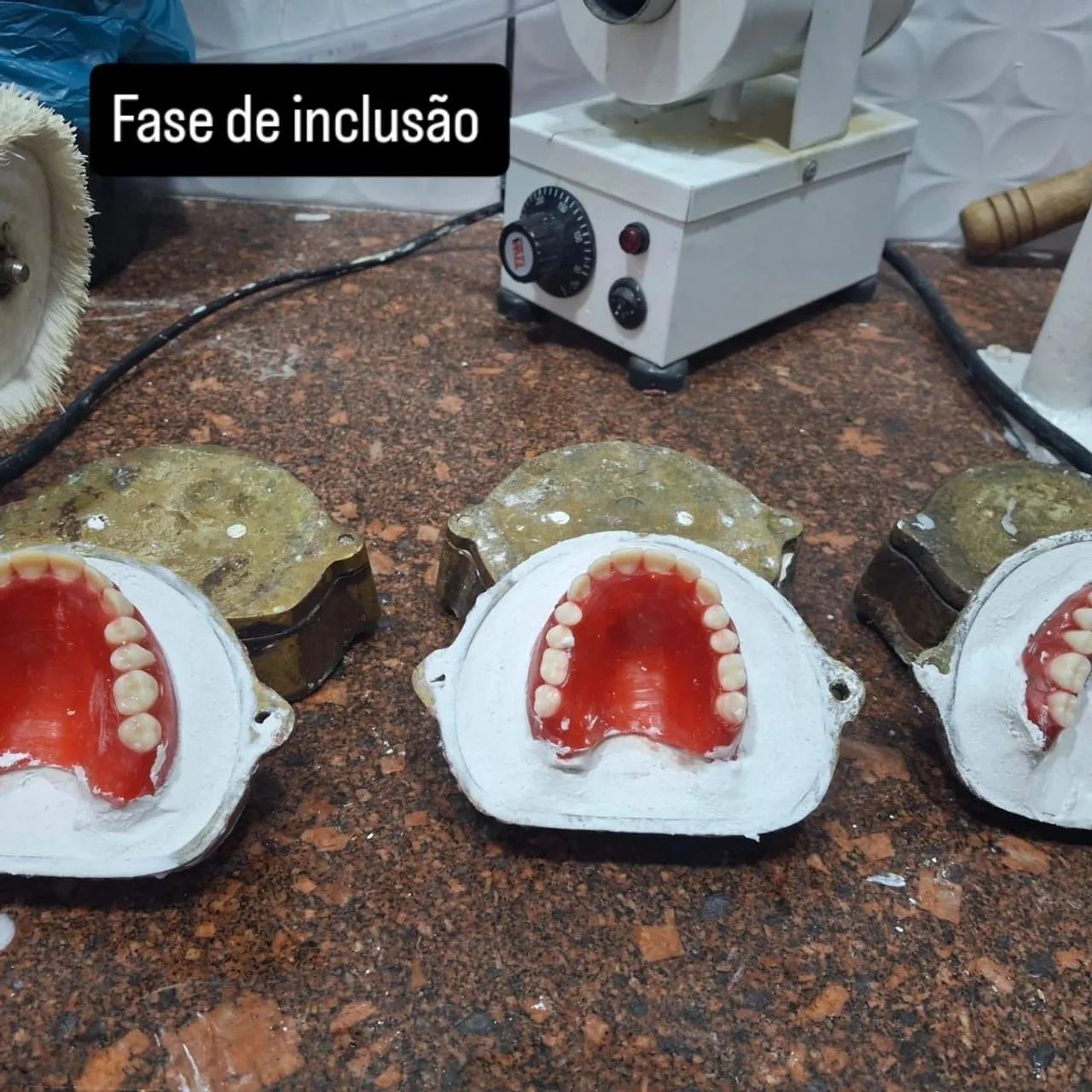 Protese dentaria nacionais e importada confira nosso inta. Labor  - Foto 4
