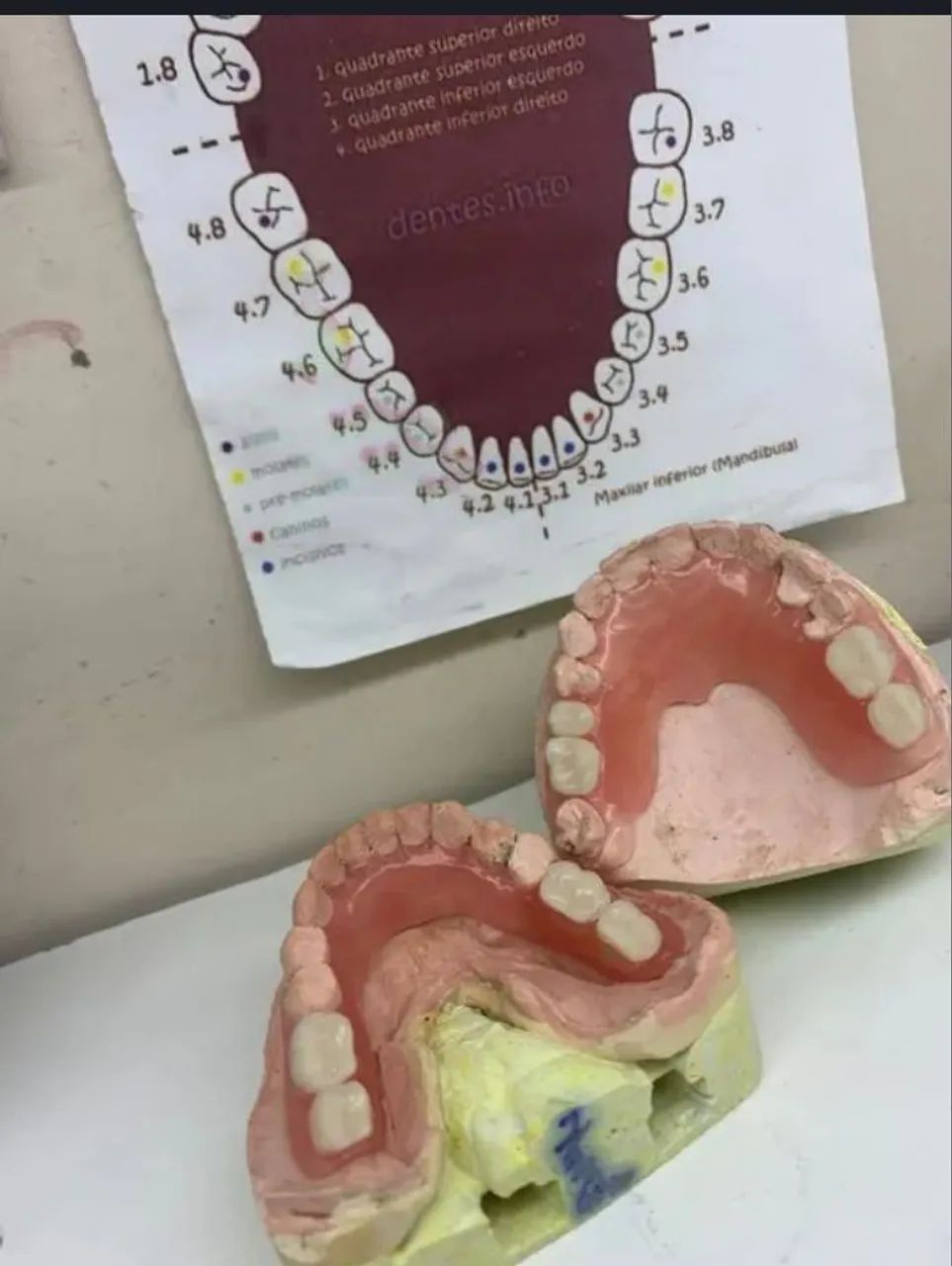 Prótese Dentária a partir de 200 reais  - Foto 3