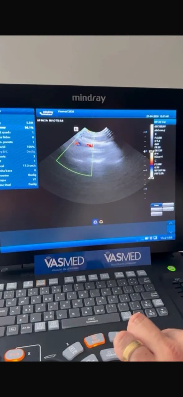 Aparelho de ultrassom 