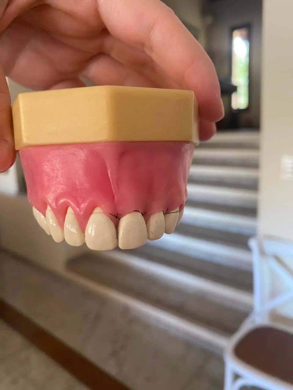 Manequim de Periodontia - Foto 4