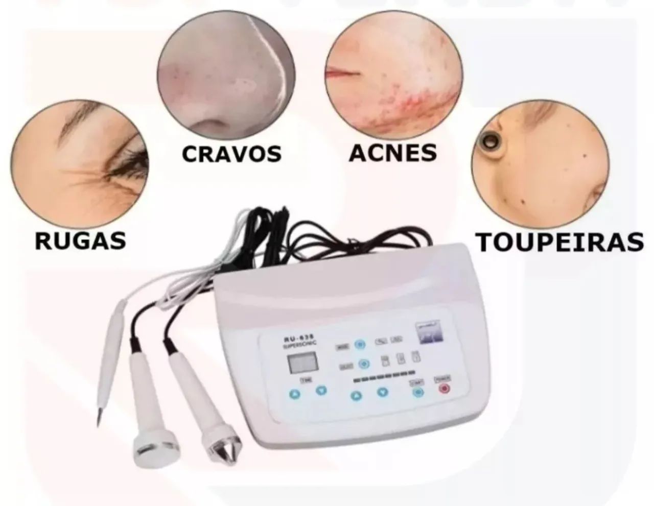 Jato de plasma , eletrocauterio e ultrasson  - Foto 4