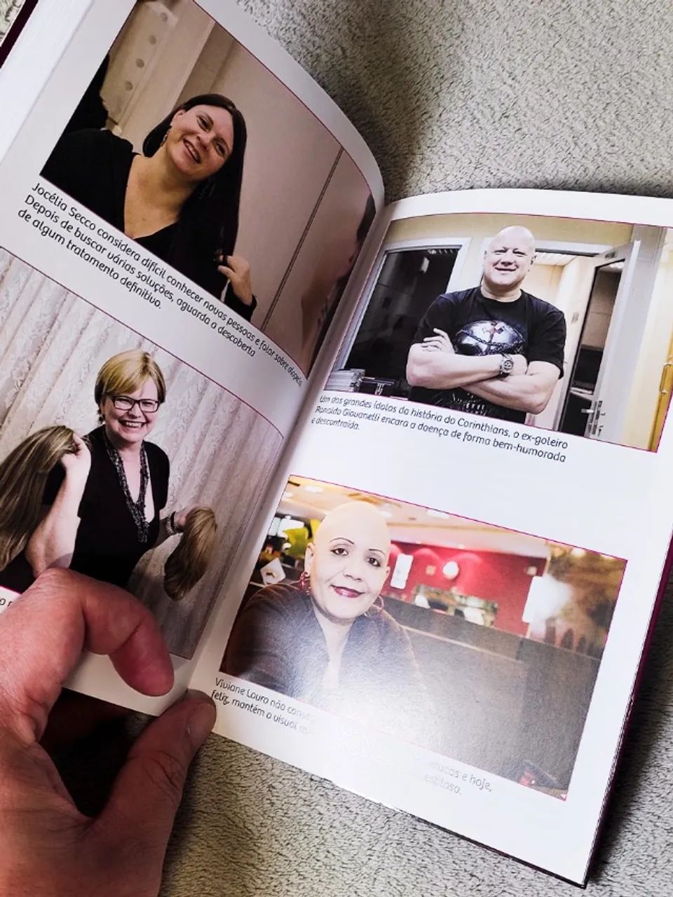Livro "Era Uma Vez Um Cabelo - Alopécia Areata" - Andressa Pedras e Beatriz Santos - Foto 5