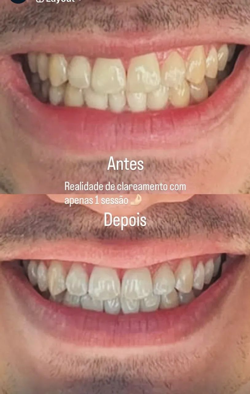 Odontólogo em Fortaleza  - Foto 5