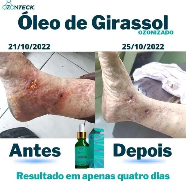 Óleo de Girassol Ozonizado