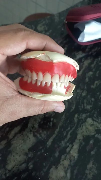 Dentadura preço mole