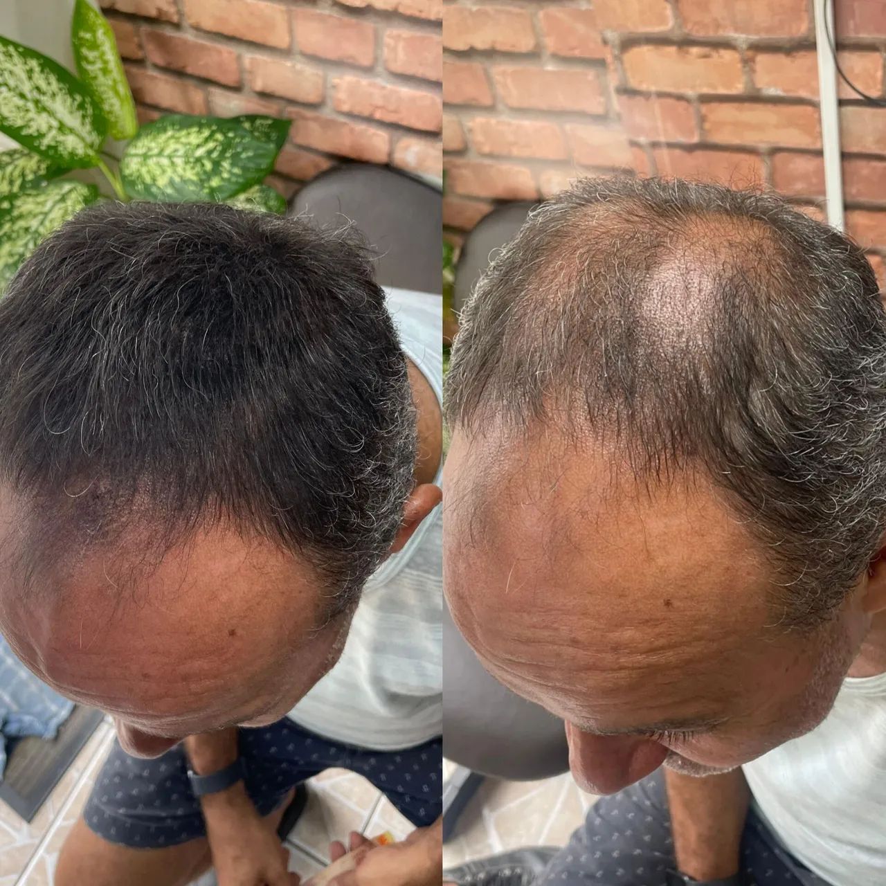Fibra capilar resultado instantânea 75 reais 