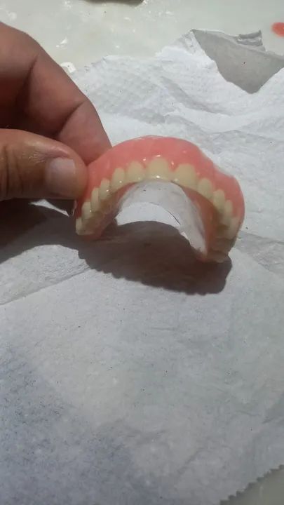 Dentadura preço mole - Foto 2