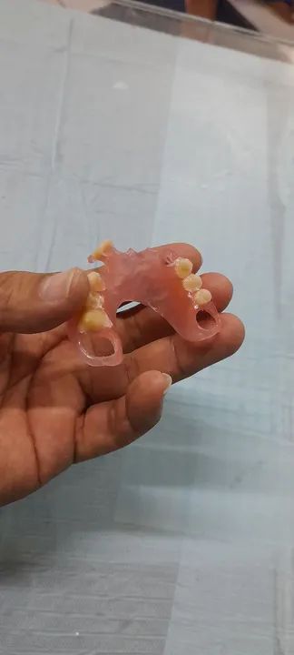 Dentadura preço mole - Foto 4