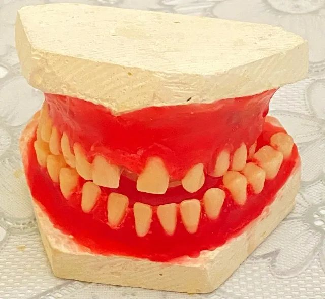 Dentes de boca p/provisório em prótese 