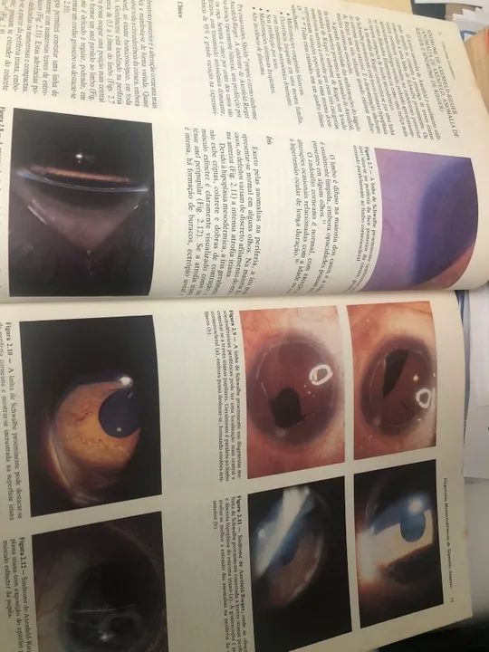 Livro: Glaucomas Secundários - 1989 - Foto 3