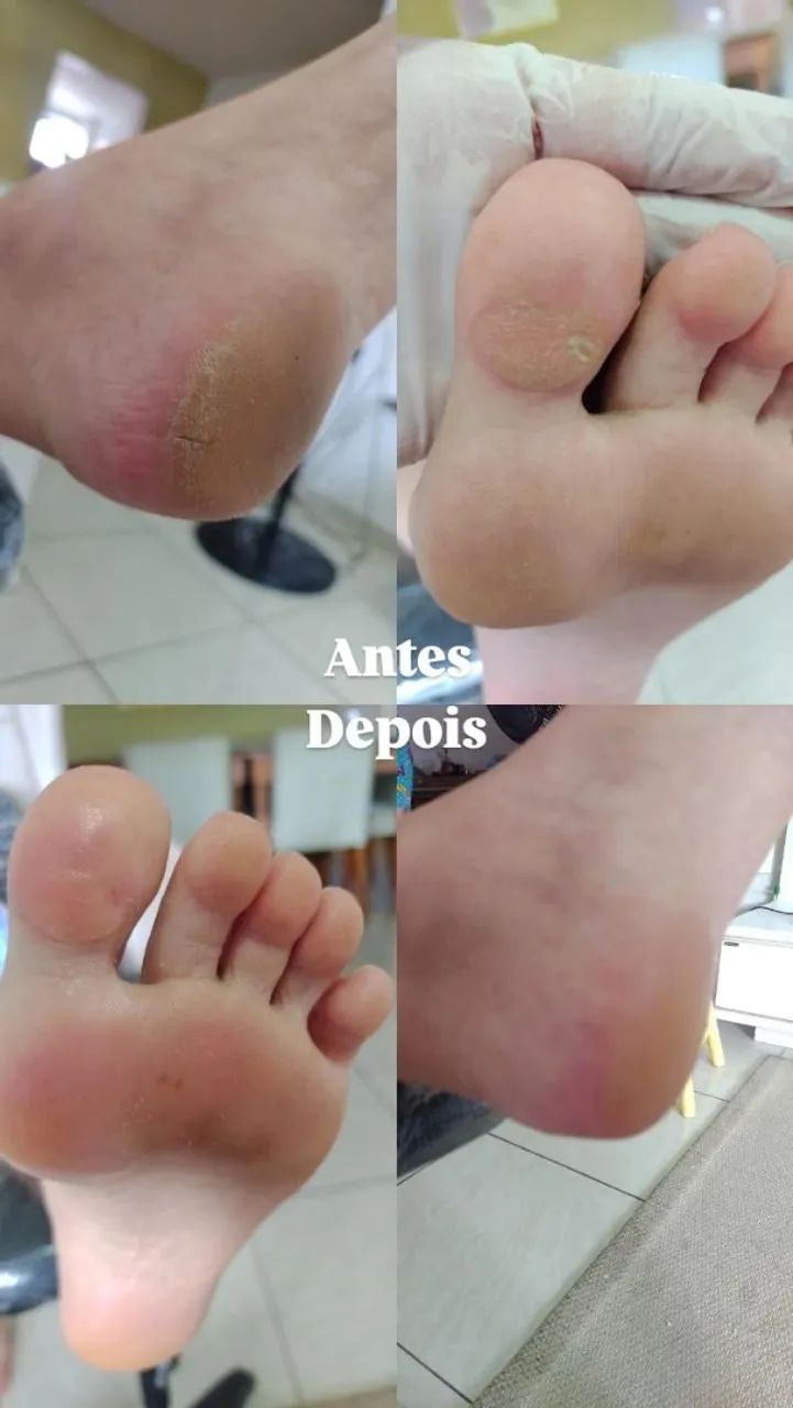 Cuidado com pés!  - Foto 3