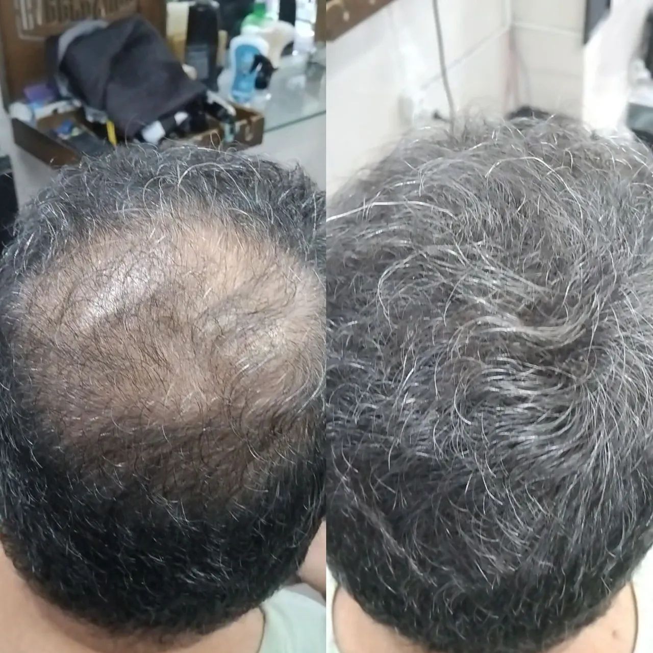Fibra capilar resultado instantânea 75 reais  - Foto 2