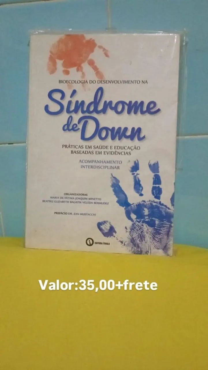 Livro sobre síndrome de Down