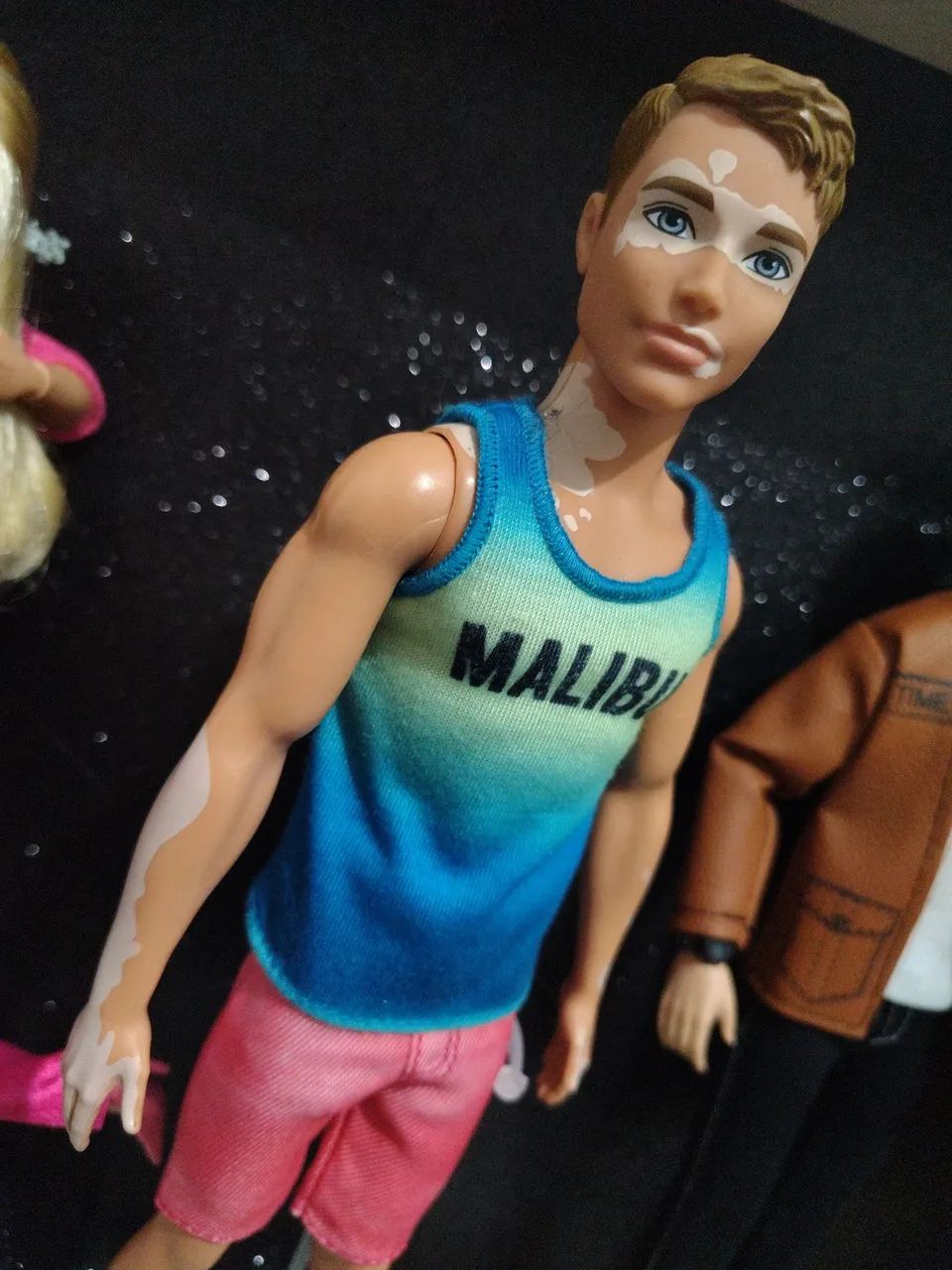 Ken fashionista virtiligio 