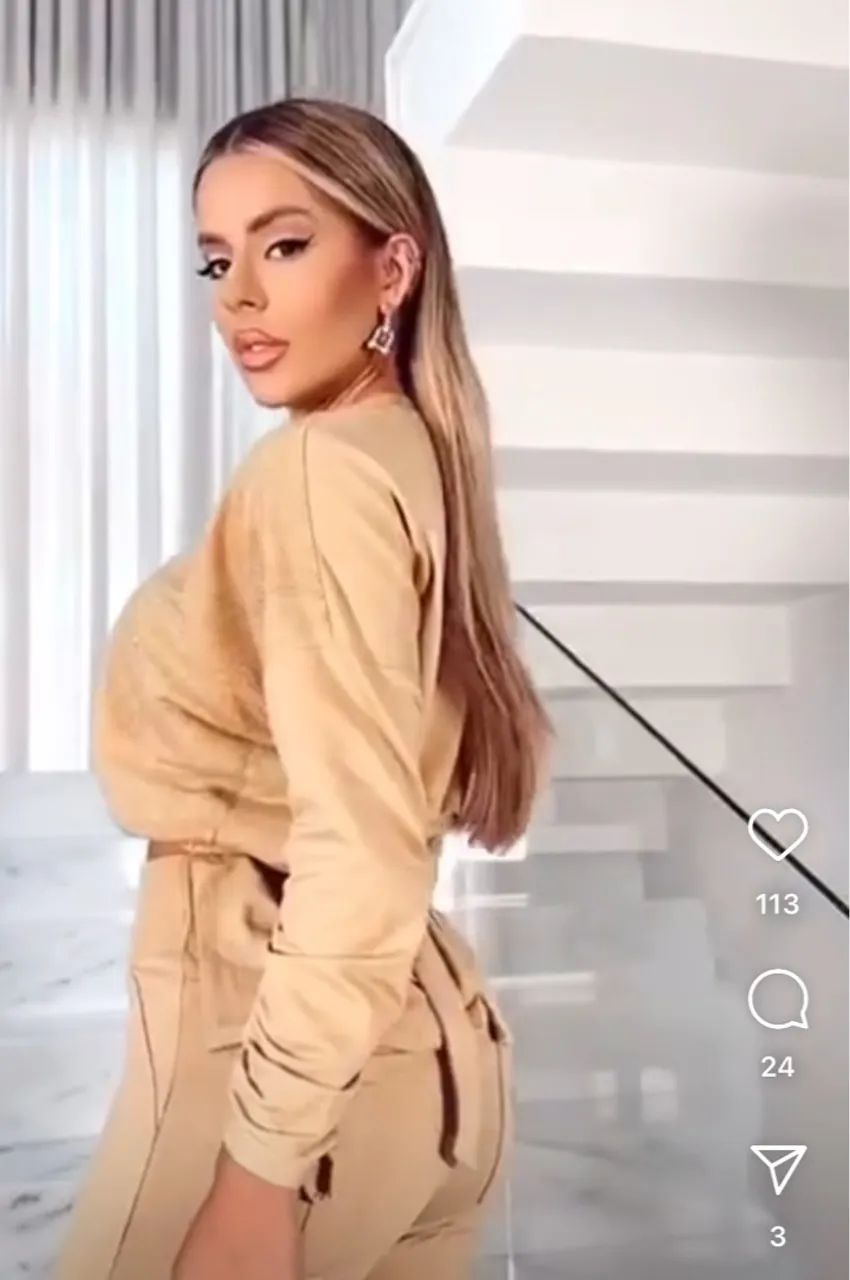 Conjunto Casual Elegante  - Foto 5