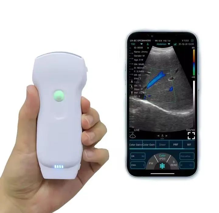 Sonda Ultrassom Scanner portátil 3 em 1 Pró 