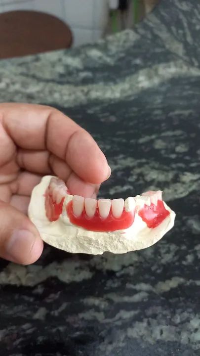 Dentadura preço mole - Foto 3