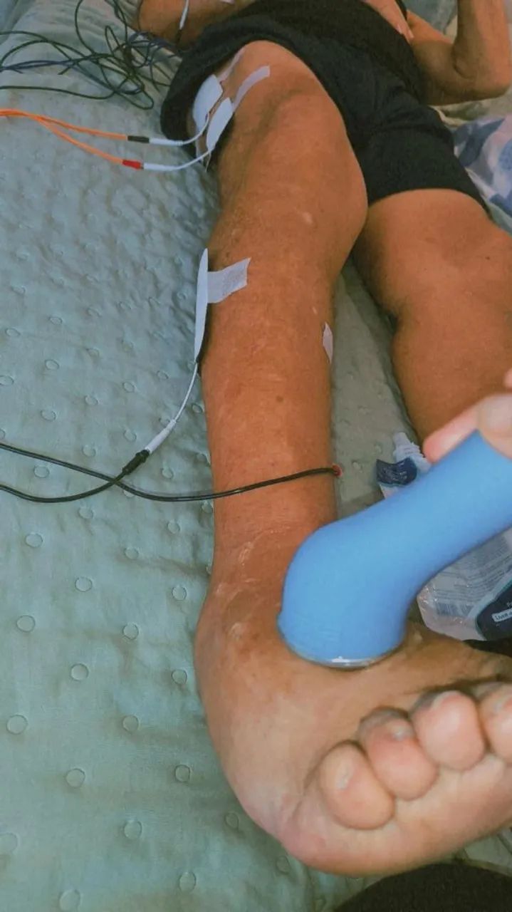 Fisioterapia Domiciliar/ Manaus  - Foto 3