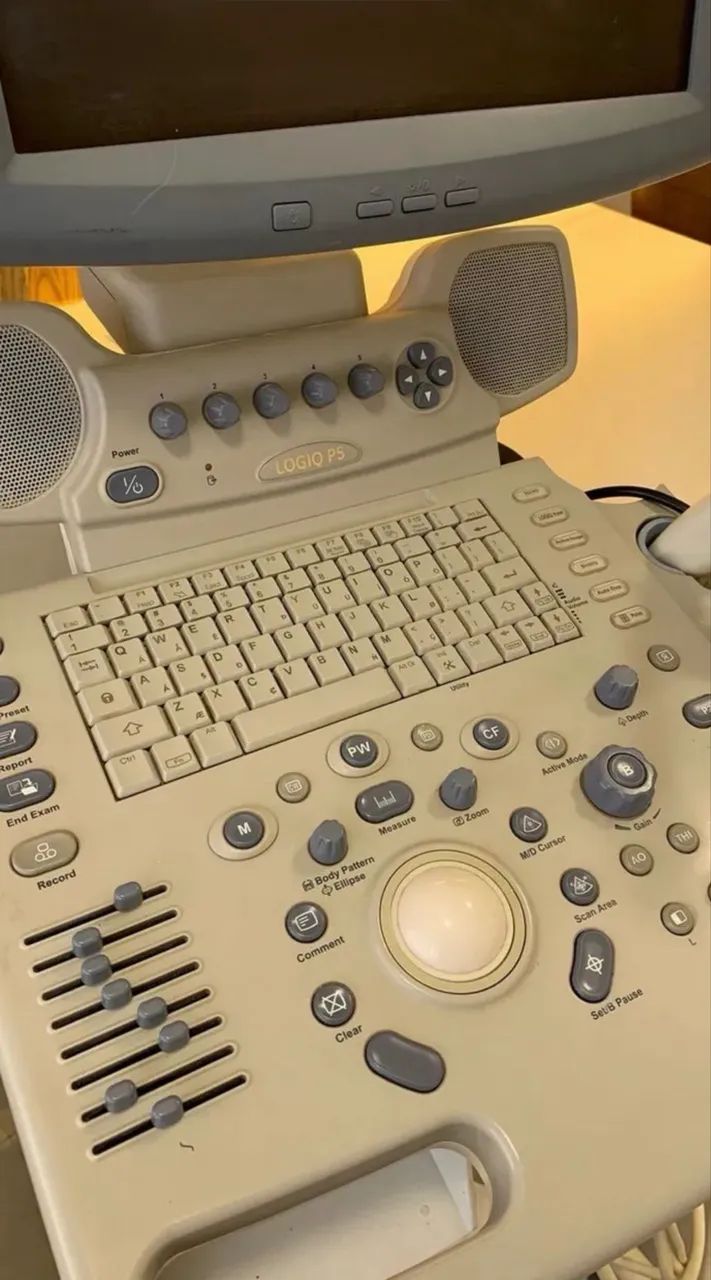 Ultrassom GE LOGIQ P5 - Foto 2