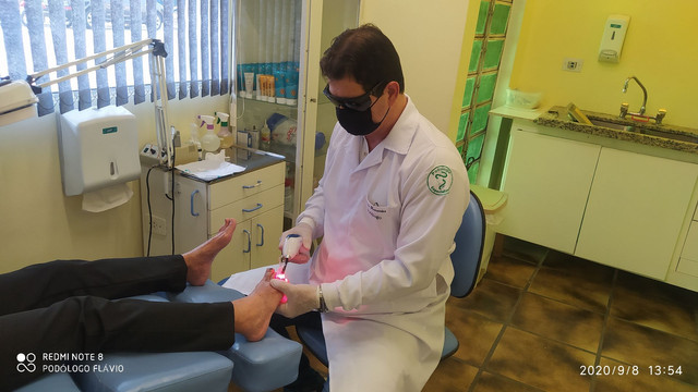 Podologo especializado em tratamento com Laser em micose de unha