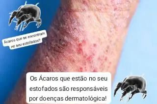 Limpeza e Higienização de Estofados - Devolvendo a Beleza ao Seu Sofá - Foto 5